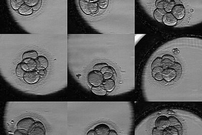 Agrandir l'image, fenêtre modale