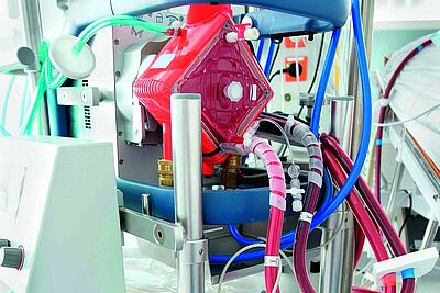 photo - ECMO (extracorporeal membrane oxygenation)