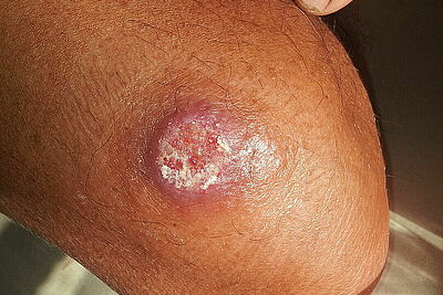 Agrandir l'image, fenêtre modale